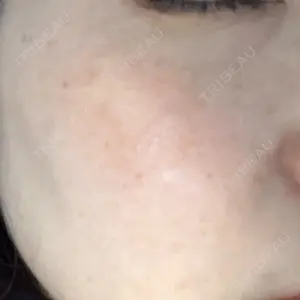 エースクリニック 大阪梅田HEPナビオ院口コミ