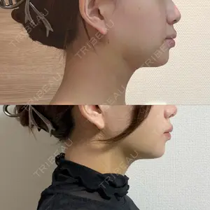 HAAB BEAUTY CLINIC 南青山本院（新院）口コミ