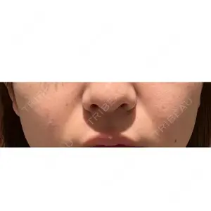 HAAB×DREAM BEAUTY CLINIC 東京本院口コミ