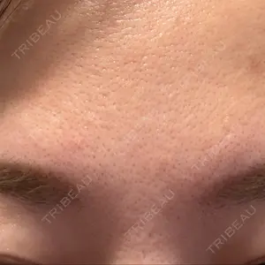 TCB東京中央美容外科 千葉駅前院口コミ