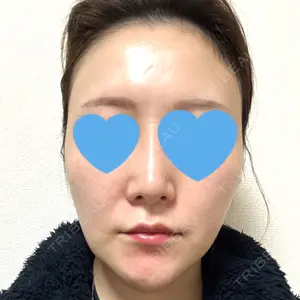 下北沢スキンクリニック口コミ