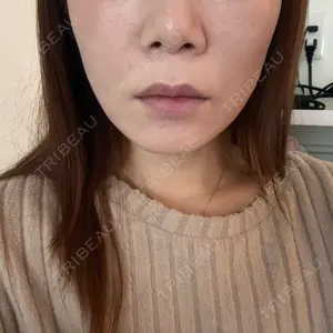 ルラ美容クリニック 上野院口コミ