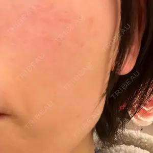 A CLINIC（エークリニック） 池袋院口コミ