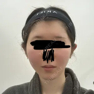 アリエル美容クリニック 大宮院口コミ