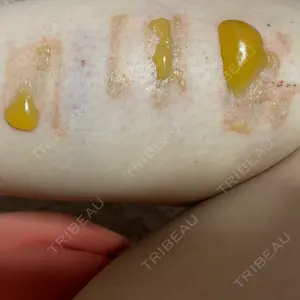 韓国みにょんクリニック口コミ