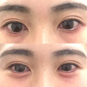 フィラークリニック 渋谷院口コミ