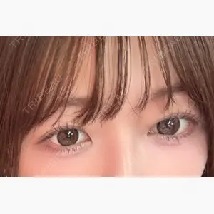 ルラ美容クリニック 上野院口コミ