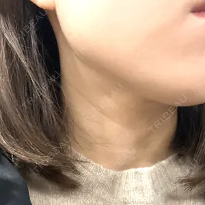 DMTC CLINIC 日本橋院口コミ