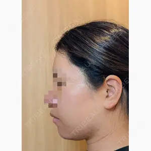 セギム美容整形外科口コミ