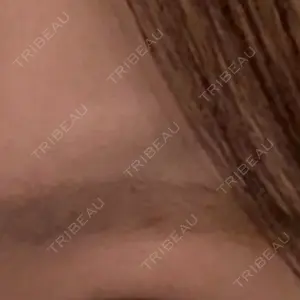 小倉美容外科/美容皮膚科 ビラビューティークリニック口コミ