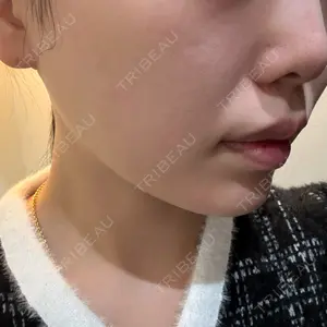 ライズワン美容皮膚科クリニック口コミ