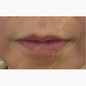 吉祥寺アイビークリニック口コミ