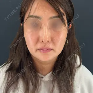 HAAB×DREAM BEAUTY CLINIC 大阪梅田院口コミ