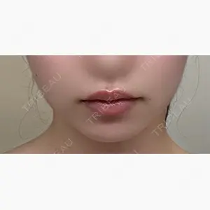 TCB東京中央美容外科 京都駅前院口コミ