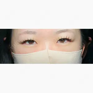 アリエル美容クリニック 大宮院口コミ