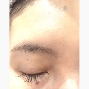 TCB東京中央美容外科 千葉東口院口コミ