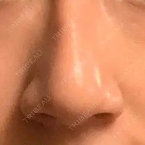 TJ美容外科口コミ