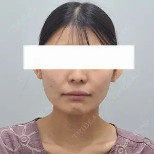 オペラ整形外科口コミ