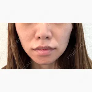 東京シンデレラ美容外科 池袋院口コミ