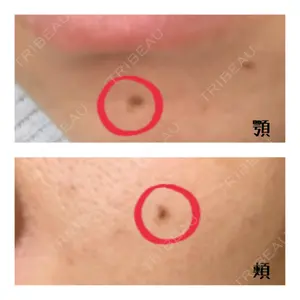 高須クリニック 栄院口コミ