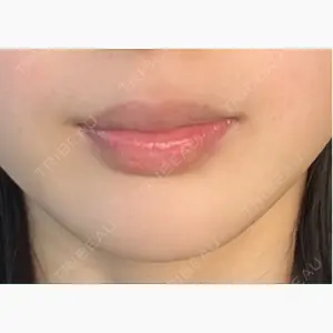 Wing clinic 豊中駅前院口コミ