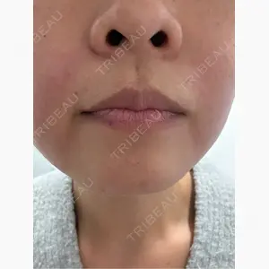 東京シンデレラ美容外科 新宿院口コミ