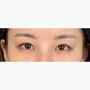 アリエル美容クリニック 大宮院口コミ