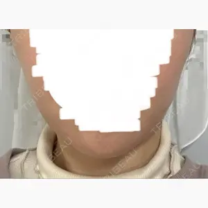 東京形成美容外科 船橋院口コミ