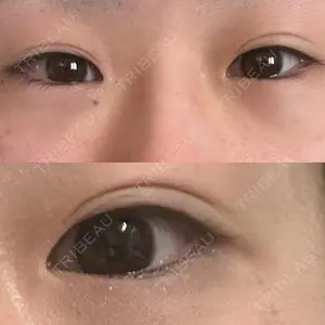 エターナル美容クリニック口コミ