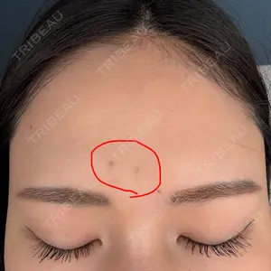 TCB東京中央美容外科 姫路院口コミ