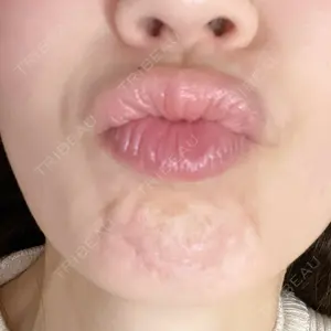 ルラ美容クリニック 静岡院口コミ