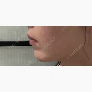 ルラ美容クリニック 京都院口コミ