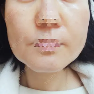 東京形成美容外科 船橋院口コミ