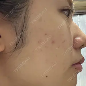 ルラ美容クリニック 福岡天神院口コミ