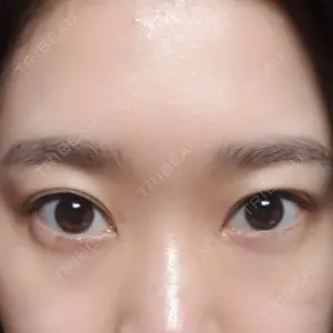 SOON PLUS整形外科口コミ