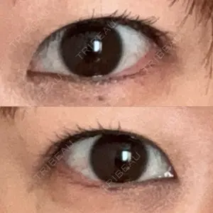 東京シンデレラ美容外科 大宮院口コミ