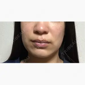 RIVER CLINIC（リバークリニック）口コミ