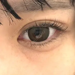 アリエル美容クリニック 水戸院口コミ