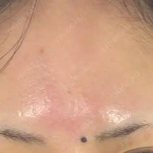 ルラ美容クリニック 大阪本院口コミ