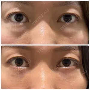 神戸美容外科 ネビュラクリニック口コミ