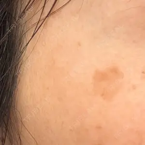 東京美容外科 名古屋院口コミ