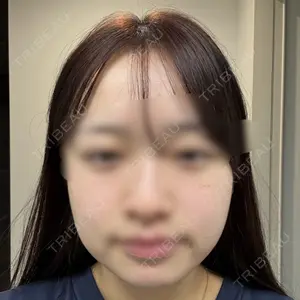 愛知春日井美容外科ネビュラクリニック口コミ