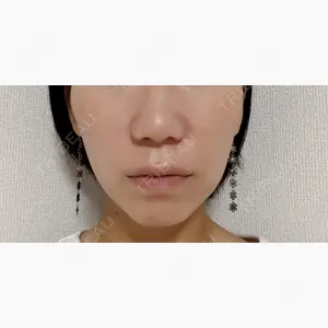LUHO（ルホ）美容外科口コミ