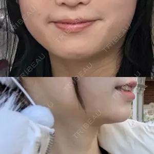 ルラ美容クリニック 福岡本院口コミ