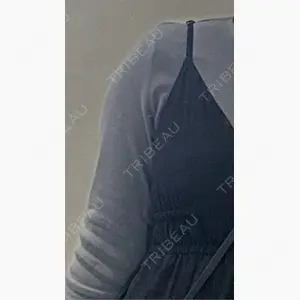 HAAB×DREAM BEAUTY CLINIC 東京本院口コミ