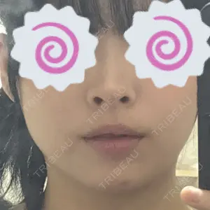 HAAB×DREAM BEAUTY CLINIC 大阪梅田院口コミ