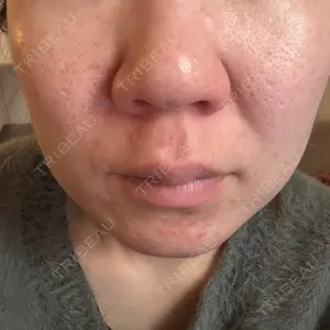 TCB東京中央美容外科 金山院口コミ