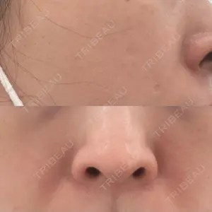 ルラ美容クリニック 札幌本院口コミ