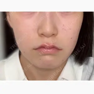 ルラ美容クリニック 大阪本院口コミ