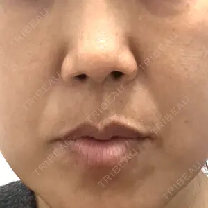 サクラアズクリニック 心斎橋院口コミ